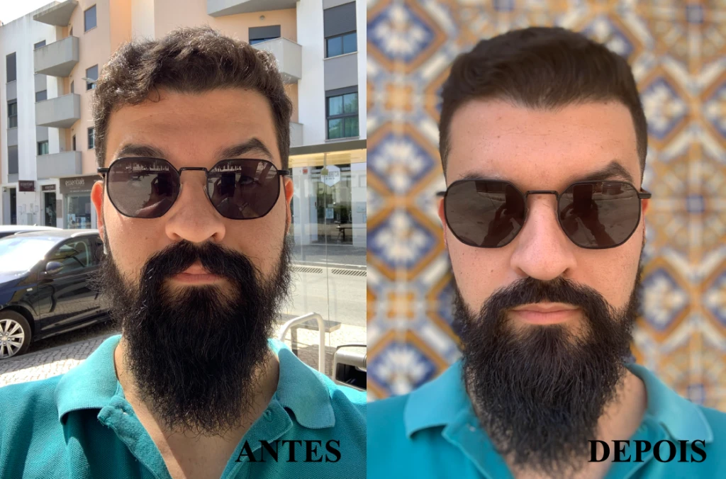 B&amp;A