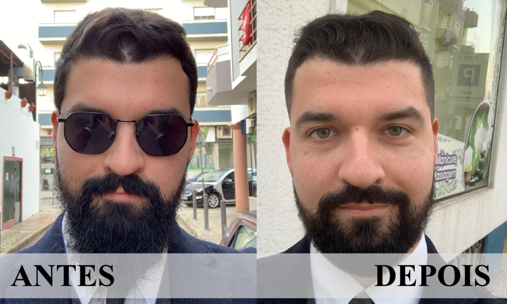 B&A